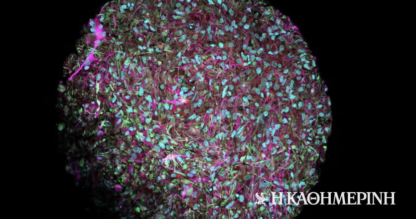 Βιολογικός υπολογιστής με εγκεφαλικά κύτταρα θα έχει «οργανοειδή νοημοσύνη»