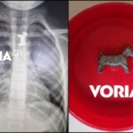 Αγοράκι κατάπιε μεταλλικό σκυλάκι από γνωστό παιχνίδι: Το έσωσαν οι γιατροί στο Ιπποκράτειο
