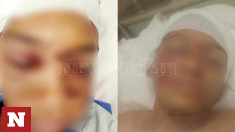 Αρτέμιδα - Επίθεση πιτ μπουλ: Στο νοσοκομείο με τραύματα στο κεφάλι ο 11χρονος
