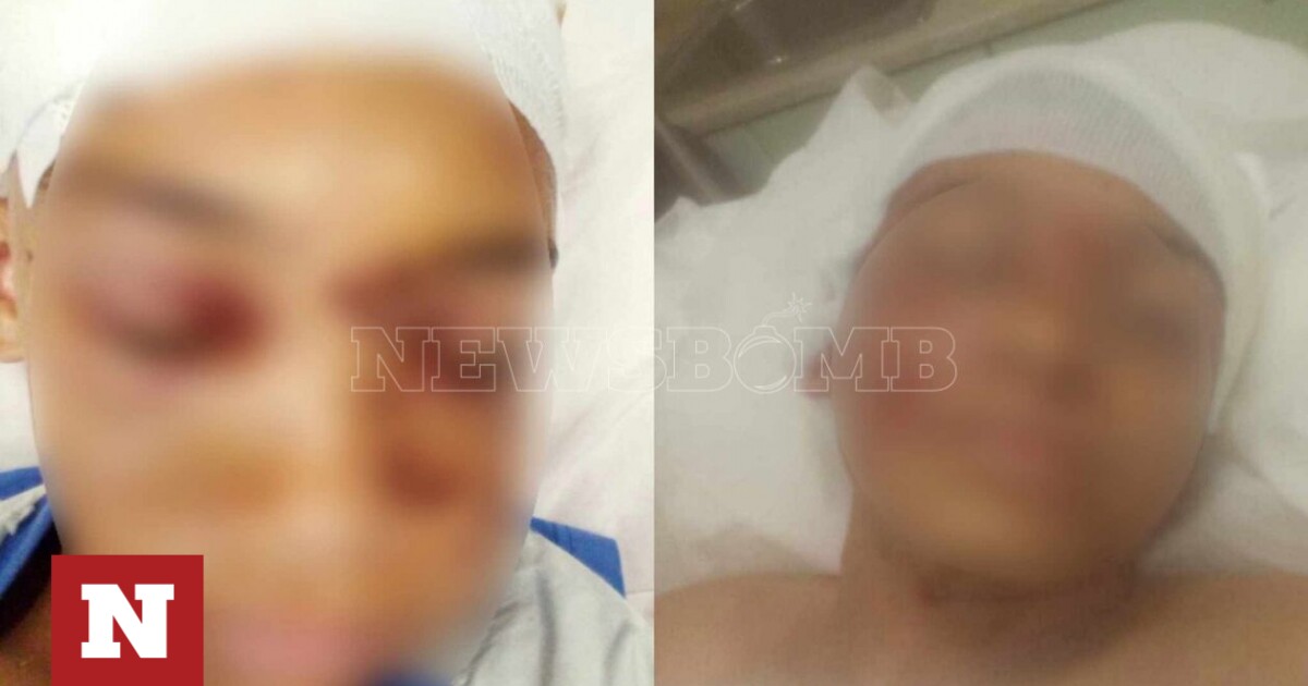 Αρτέμιδα - Επίθεση πιτ μπουλ: Στο νοσοκομείο με τραύματα στο κεφάλι ο 11χρονος