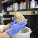 Γαλλία: Εγκεφαλικά οργανοειδή θα σταλούν στον Διεθνή Διαστημικό Σταθμό για να μελετηθεί η διαδικασία της γήρανσης