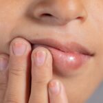 Καρδιακή προσβολή: Αυξημένος κίνδυνος αν συμβαίνει αυτό στο στόμα σας