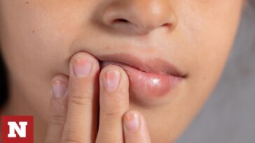 Καρδιακή προσβολή: Αυξημένος κίνδυνος αν συμβαίνει αυτό στο στόμα σας